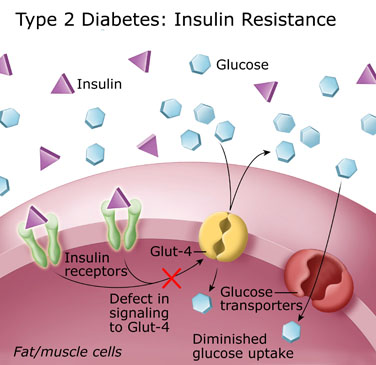 Type 2 Diabetes molecular level diagram